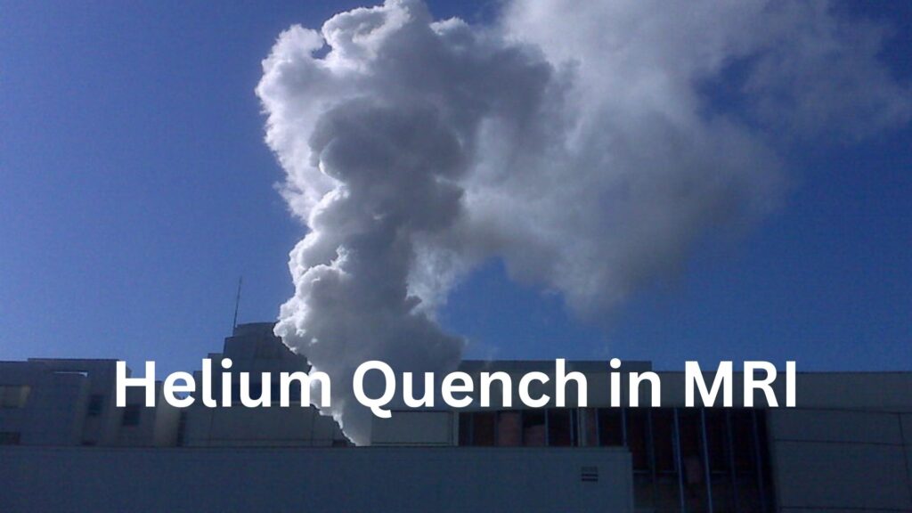 Helium Quench in MRI What you need to know CTMRIHUB